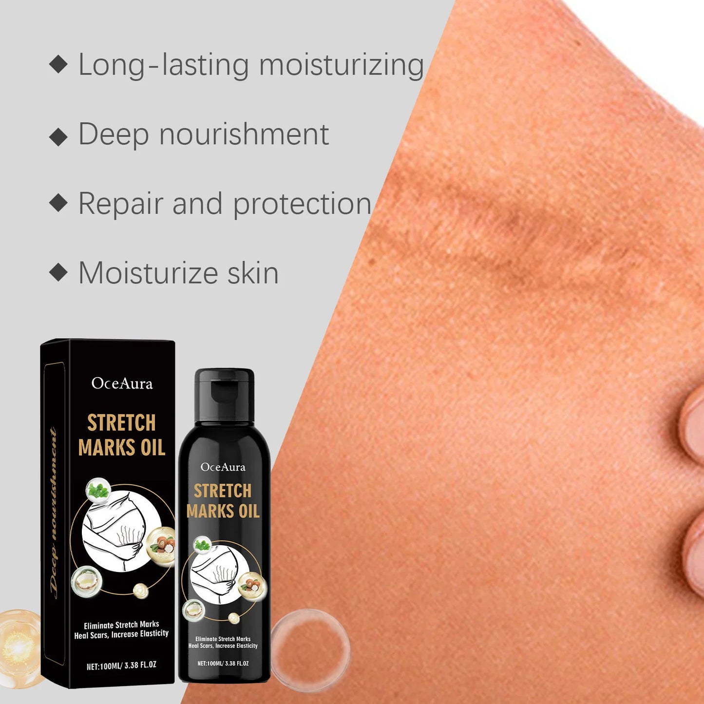 Stretch Marks Removal Oil